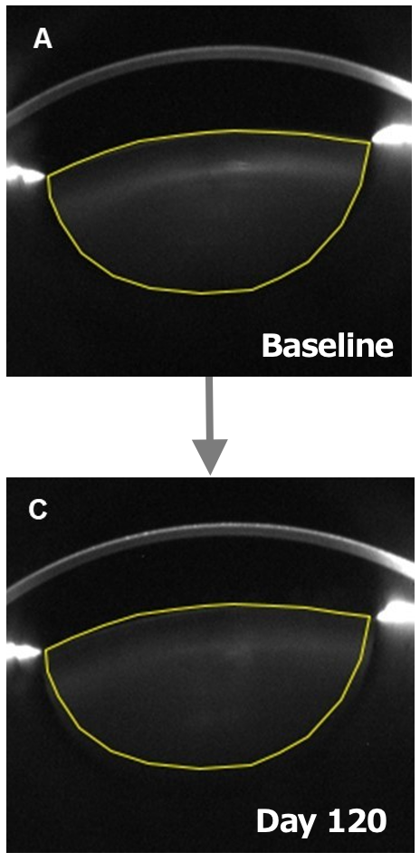 Lens Density Images